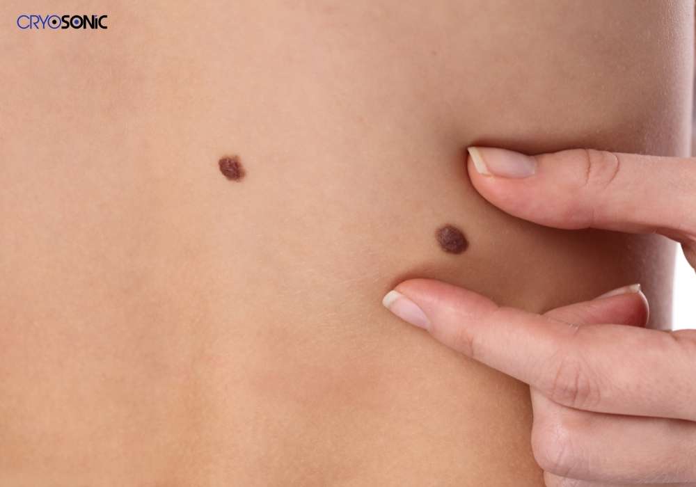 Infection Risk and Poor Aftercare Harrogate