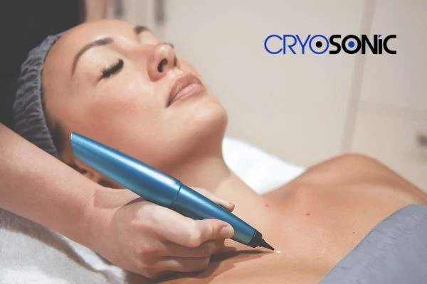 Cryosonic lesion removal prices book today! Harrogate