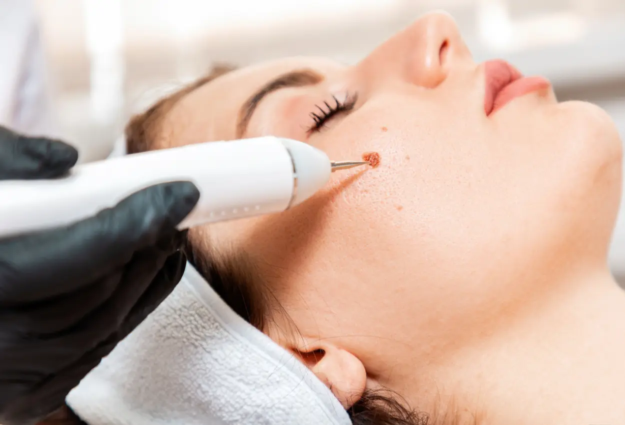 Frequently Asked Questions About Multiple Cryotherapy Treatments Harrogate