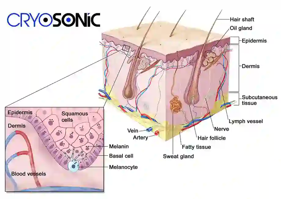 How Cryotherapy Stimulates Melanocyte Activity  Harrogate